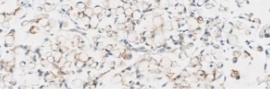 Tissue sample showing weak staining