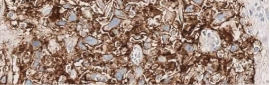 Tissue sample showing moderate staining