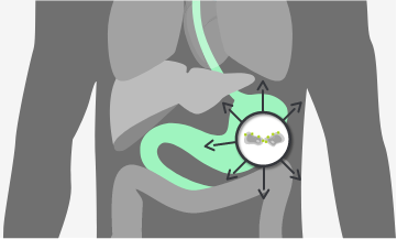 CLDN18.2 expressed in lymph node metastases of gastric adenocarcinoma and other metastatic sites 